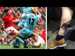 Video: Hirveimmät loukkaantumiset XI